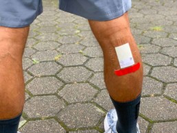 Pflaster vom Sweat Pack klebt auf rechter Wade